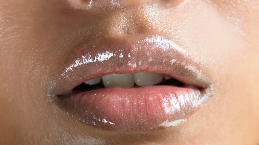 An Artificial Hack To Make Lips Good: Lip Filler