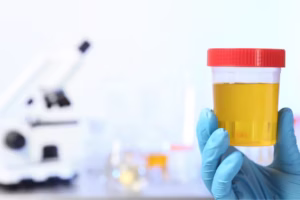 Role of synthetic urine kits in laboratory calibration